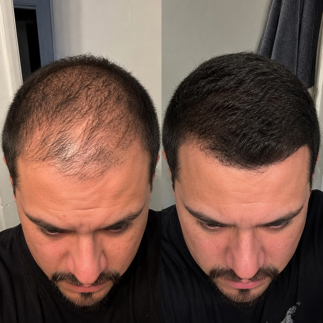 EXCALVO SHAMPOO BLACK EDITION